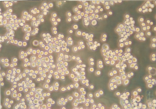 COLO 205细胞图片